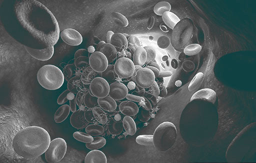 CFS and Long Covid: new biomarkers link the two syndromes and points to new therapy strategies