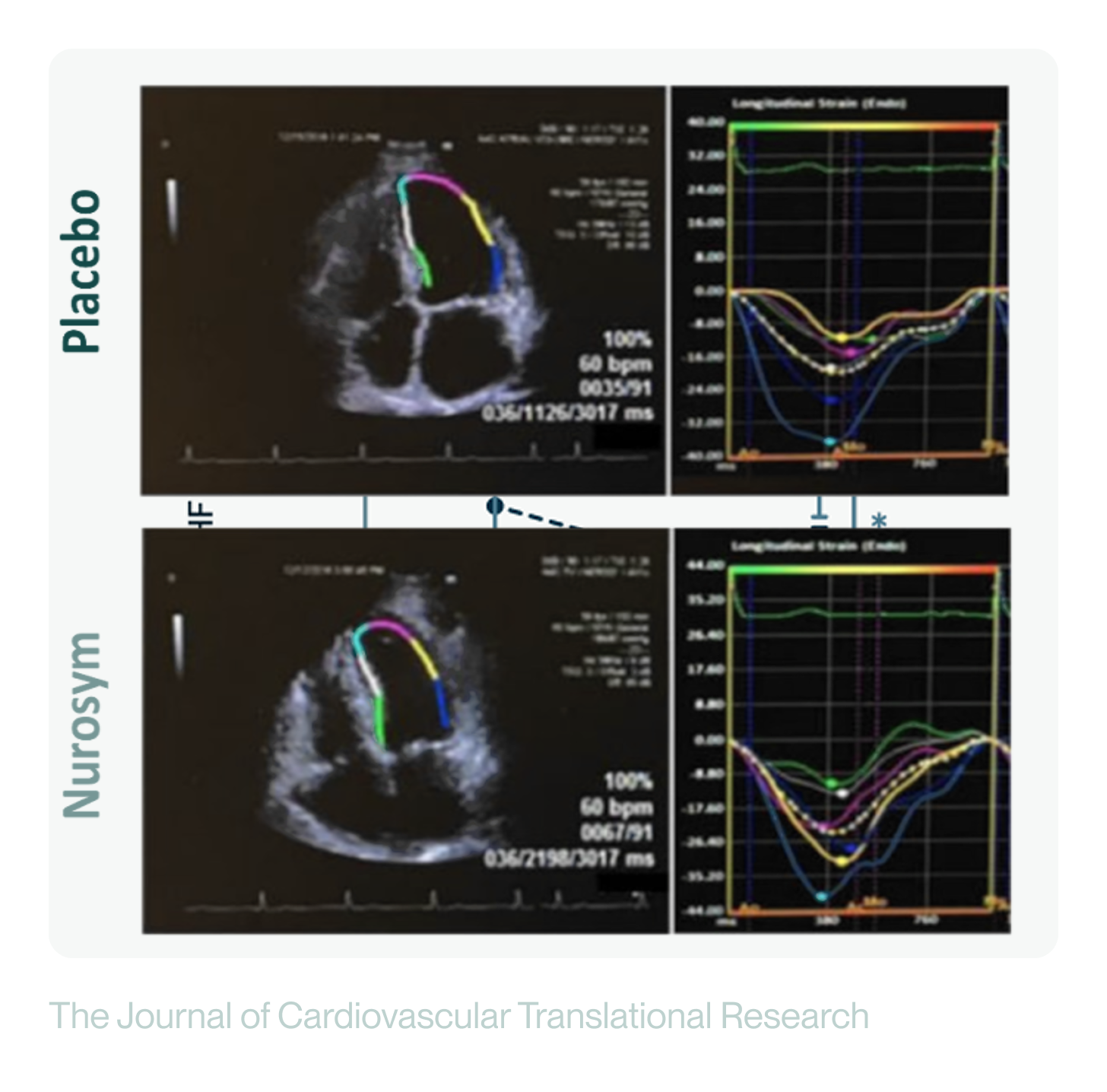 Nurosym-placebo-image