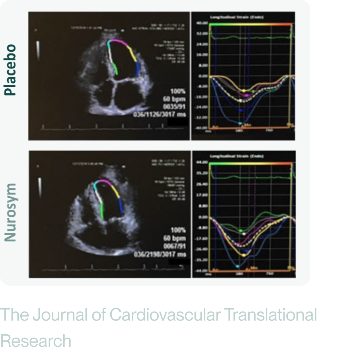 Nurosym-placebo-image
