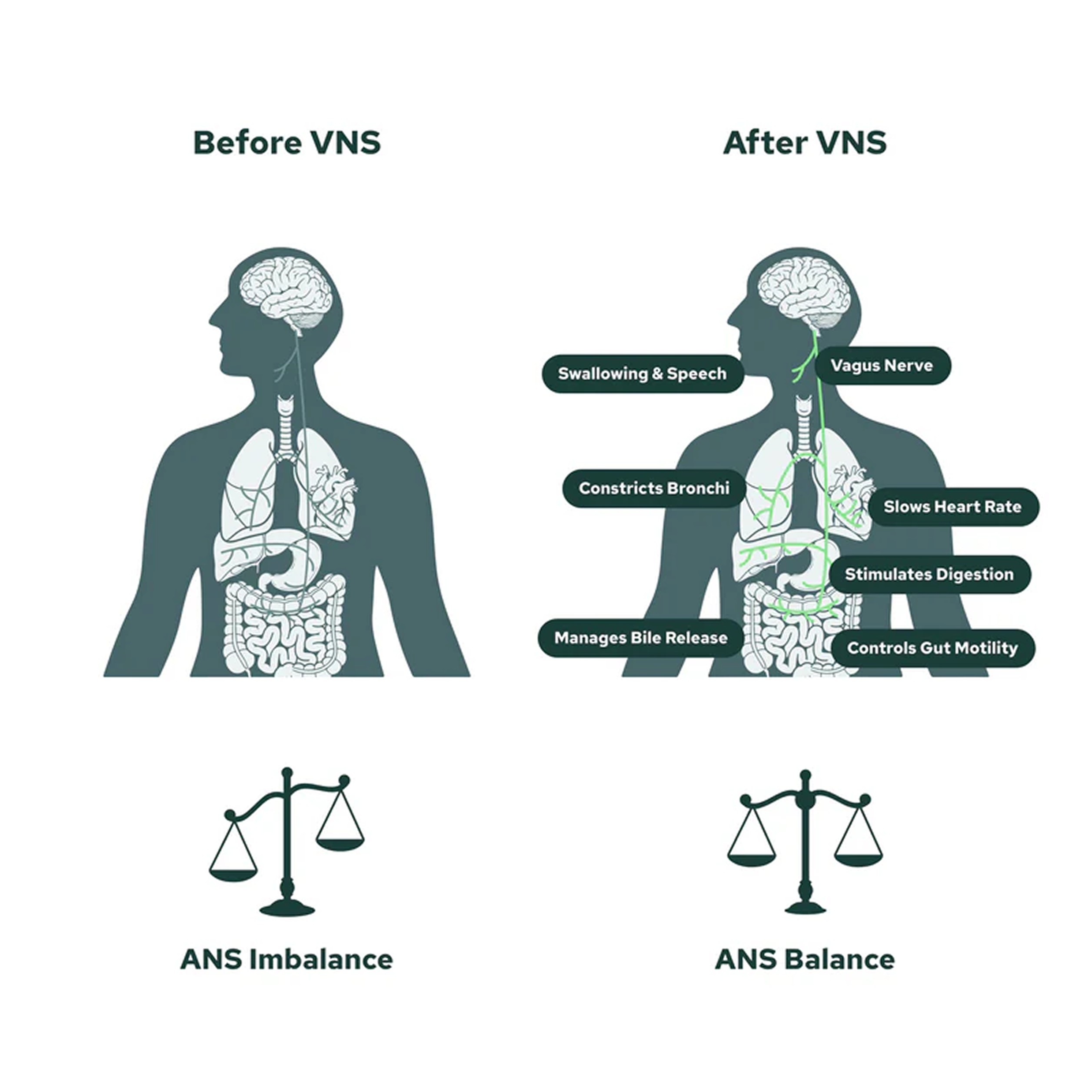 Regaining Energy Levels Starts With Rebalancing the Nervous System