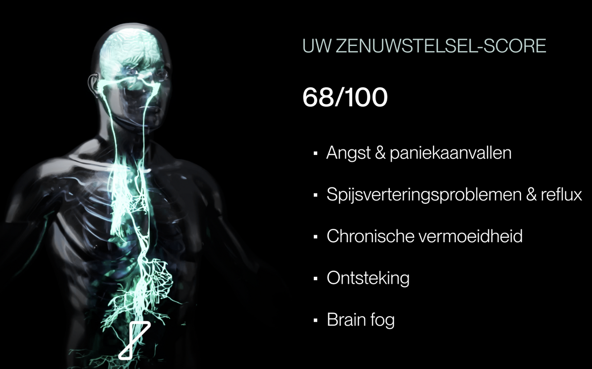 Vagus Nerve