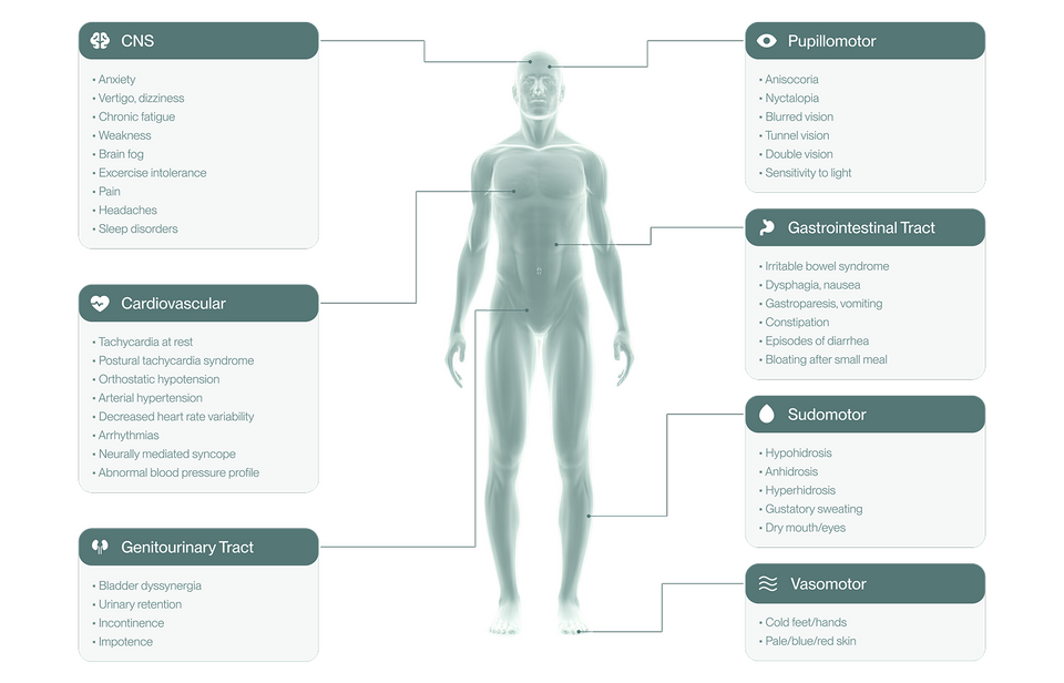 See Conditions Linked To Vagus Nerve Impairment