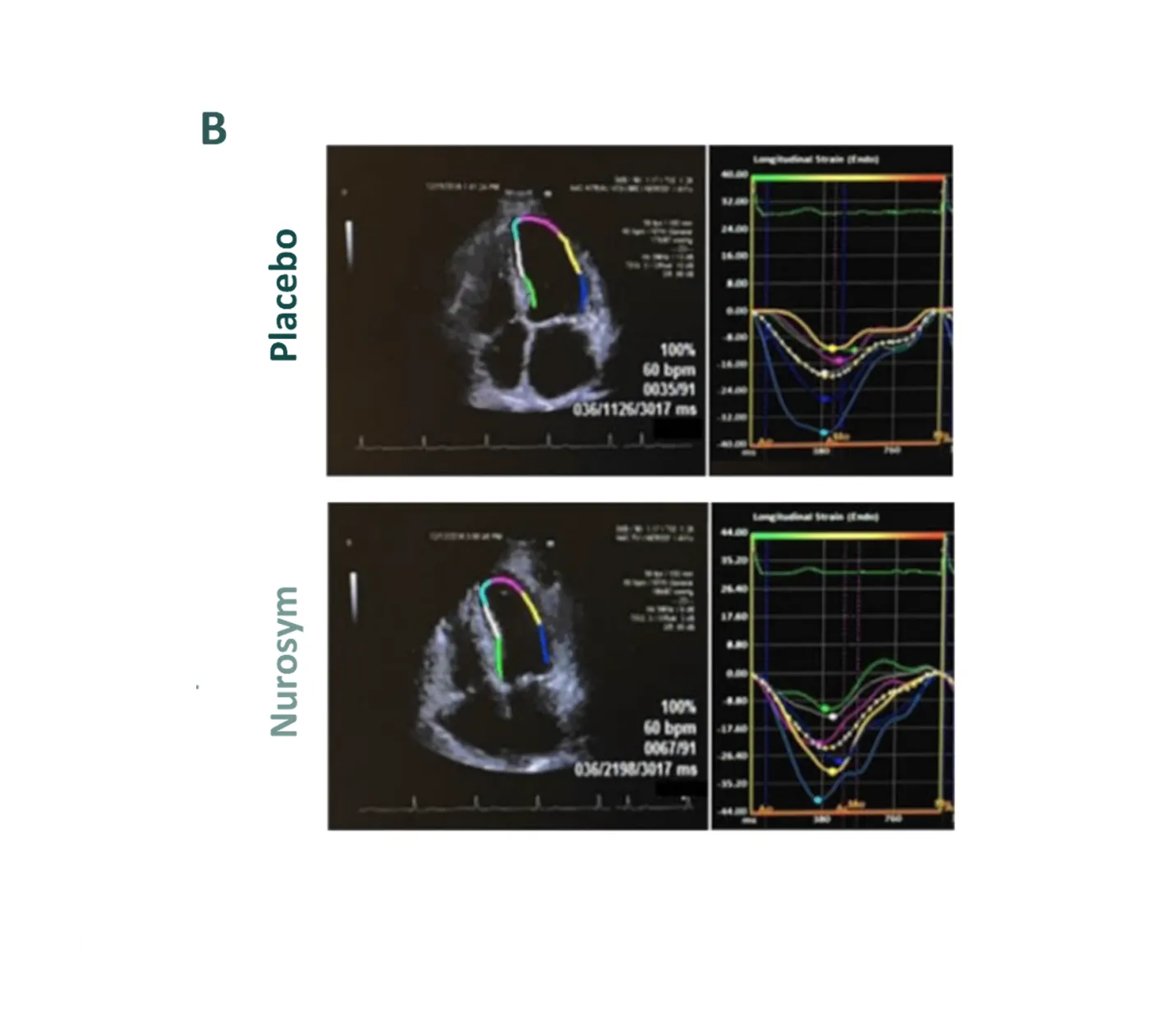 Nurosym-placebo-image