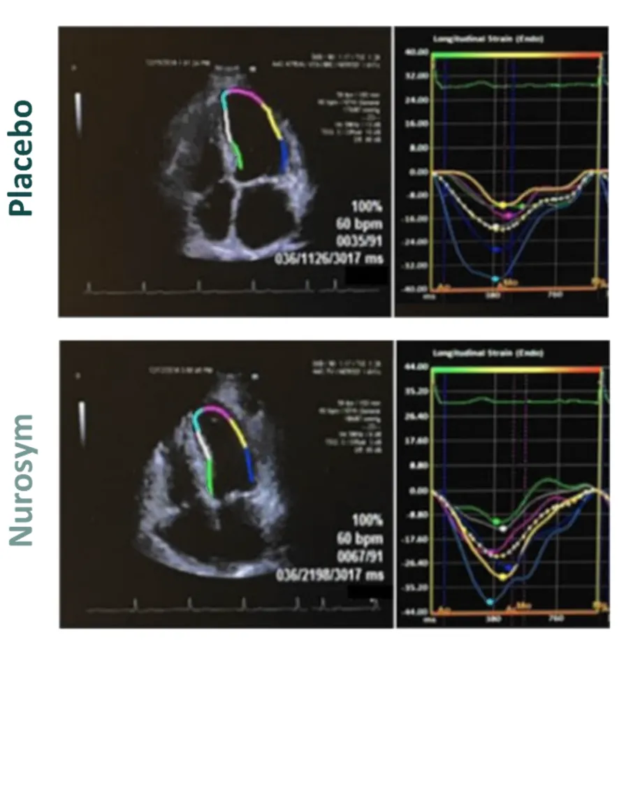Nurosym-placebo-image
